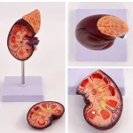 1:1 Life-Size Kidney Model Realistic Anatomical Internal Organ Structure for Medical Science Teaching Simulation