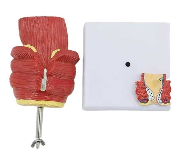 2-Part Anatomical Hemorrhoid Model for Medical Education & Pathology Demonstration Educational Equipment