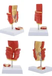 2-Part Anatomical Hemorrhoid Model for Medical Education & Pathology Demonstration Educational Equipment
