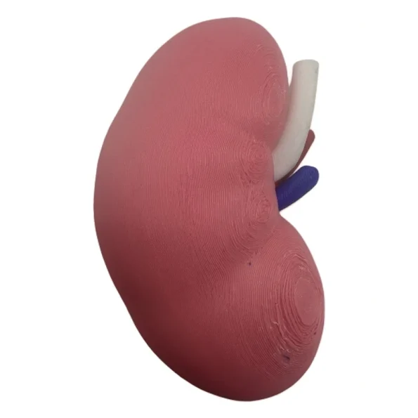 3D Printed Human Kidney Cross Section Anatomy Model Color Coded Renal Vessel Structure Demonstration Model