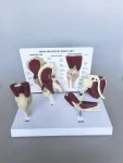 4 in 1 Human Mini Joint Anatomy Model Set Hip Knee Elbow Shoulder With Muscles for Teaching Display Learning Tool