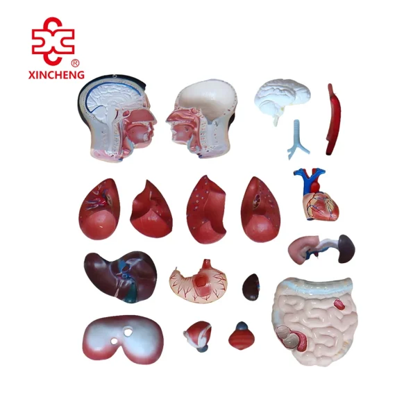 85CM Male Torso 19 Parts (European Face) PVC Material Medical School Teaching Model