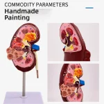 Anatomical PVC Kidney Model for Medical School Teaching Simulating Diseased Kidney and Urinary System