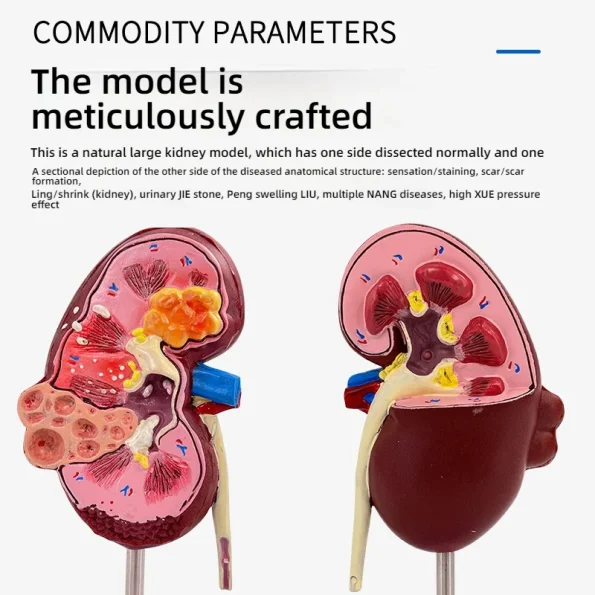 Anatomical PVC Kidney Model for Medical School Teaching Simulating Diseased Kidney and Urinary System