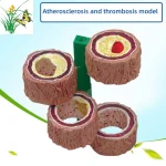 Anatomical PVC Model for Medical Science Four Stages of Artery Atherosclerosis and Thrombosis Training Model