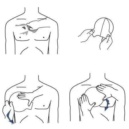 Chest Seal Hydrocolloid Dressing, Emergency Chest Sealing Patch for First Aid Training Outdoor Rescue
