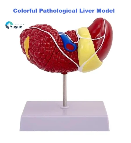 Clear Durable & Educational Pathological Liver Model for Educational Equipment