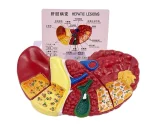 Clear Durable & Educational Pathological Liver Model for Educational Equipment