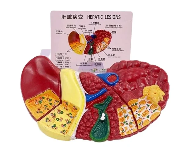 Clear Durable & Educational Pathological Liver Model for Educational Equipment