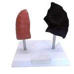 Comparative Model for Smoker's Lung Vs Normal Lung Educational Equipment
