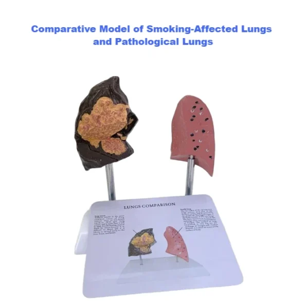 Comparative Model for Smoker's Lung Vs Normal Lung Educational Equipment