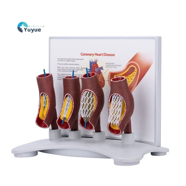 Educational Equipment 4-Stage Stent Deployment Demonstration Model for Coronary Heart Disease