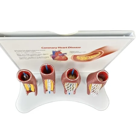 Educational Equipment 4-Stage Stent Deployment Demonstration Model for Coronary Heart Disease