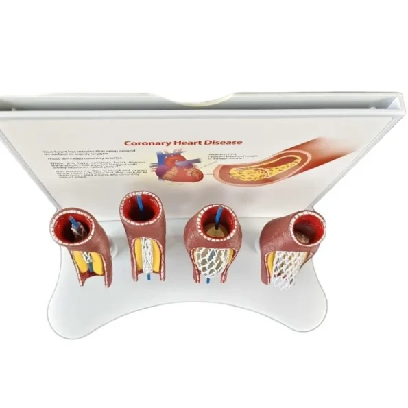 Educational Equipment 4-Stage Stent Deployment Demonstration Model for Coronary Heart Disease