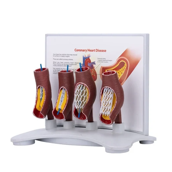 Educational Equipment 4-Stage Stent Deployment Demonstration Model for Coronary Heart Disease