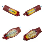 Educational Equipment 4-Stage Stent Deployment Demonstration Model for Coronary Heart Disease