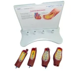 Educational Equipment 4-Stage Stent Deployment Demonstration Model for Coronary Heart Disease