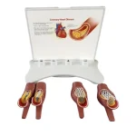 Educational Equipment 4-Stage Stent Deployment Demonstration Model for Coronary Heart Disease