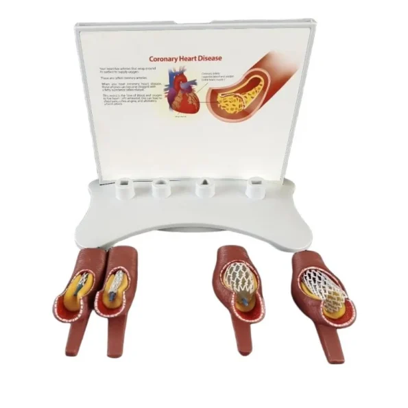 Educational Equipment 4-Stage Stent Deployment Demonstration Model for Coronary Heart Disease