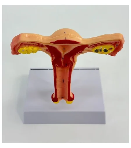 Female Reproductive System Anatomical Model Uterus and Ovary Gynecological Teaching Simulator for Medical Science