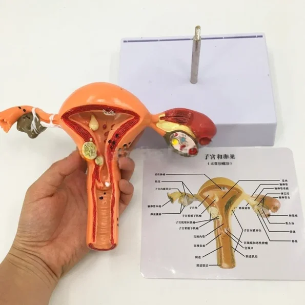 Female Reproductive System Anatomy Teaching Tool Human Uterus Model with Vagina & Ovaries Pathological Simulation Organ Model