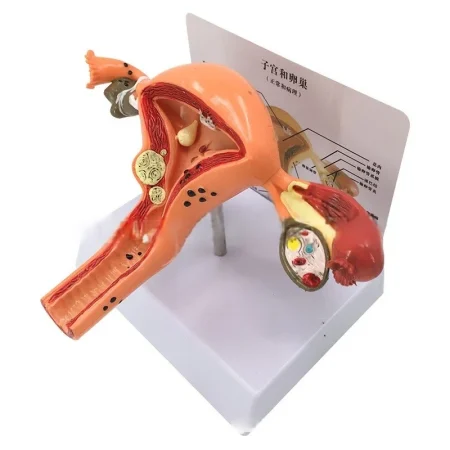 Female Reproductive System Anatomy Teaching Tool Human Uterus Model with Vagina & Ovaries Pathological Simulation Organ Model