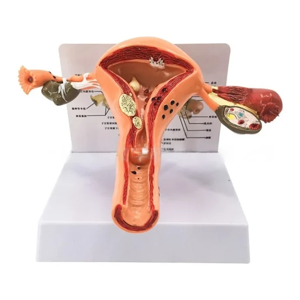 Female Reproductive System Anatomy Teaching Tool Human Uterus Model with Vagina & Ovaries Pathological Simulation Organ Model