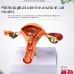 Female Reproductive System Anatomy Teaching Tool Human Uterus Model with Vagina & Ovaries Pathological Simulation Organ Model