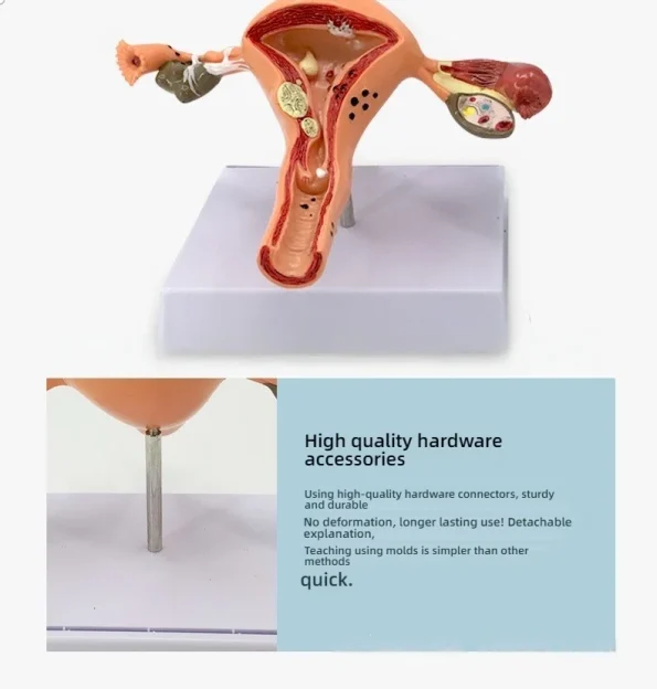 Female Reproductive System Anatomy Teaching Tool Human Uterus Model with Vagina & Ovaries Pathological Simulation Organ Model
