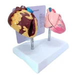 Heart Anatomy Model for Health Education Normal & Smoking Categories Educational Equipment