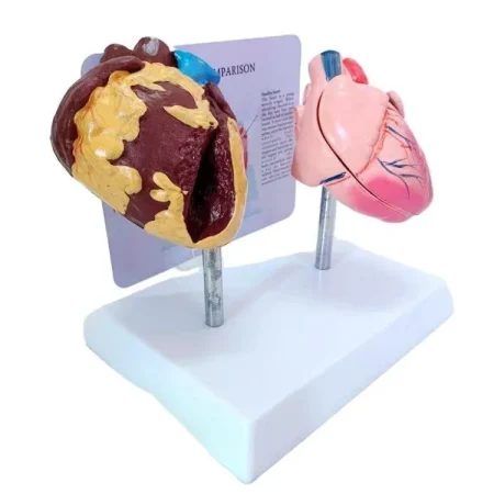 Heart Anatomy Model for Health Education Normal & Smoking Categories Educational Equipment