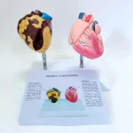 Heart Anatomy Model for Health Education Normal & Smoking Categories Educational Equipment