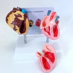 Heart Anatomy Model for Health Education Normal & Smoking Categories Educational Equipment