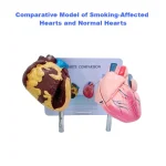 Heart Anatomy Model for Health Education Normal & Smoking Categories Educational Equipment