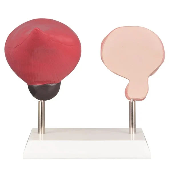 Human Bladder Model Set Normal Vs Smoking-Induced Changes for Educational Purposes