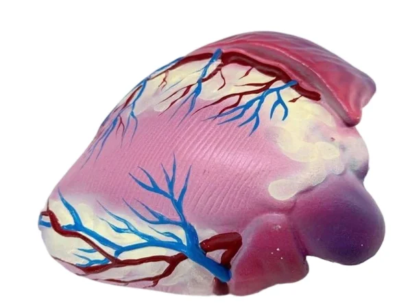 Human Cardiovascular Thrombus & Artery Blockage Anatomical Model Educational Equipment