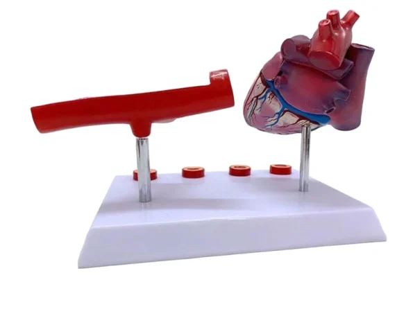 Human Cardiovascular Thrombus & Artery Blockage Anatomical Model Educational Equipment