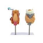 Human Pathological PVC Anatomical Model Thyroid Gland for Medical Science for Teaching Hyperthyroidism Hypothyroidism Schools