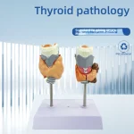 Human Pathological PVC Anatomical Model Thyroid Gland for Medical Science for Teaching Hyperthyroidism Hypothyroidism Schools