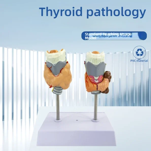 Human Pathological PVC Anatomical Model Thyroid Gland for Medical Science for Teaching Hyperthyroidism Hypothyroidism Schools