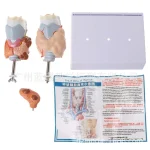 Human Pathological PVC Anatomical Model Thyroid Gland for Medical Science for Teaching Hyperthyroidism Hypothyroidism Schools