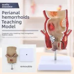 Human Rectum Anatomy Model PVC Medical Science Training Education for Pathological Hemorrhoids Internal External Hemorrhoid