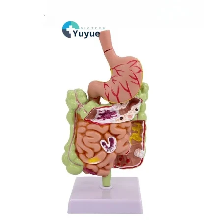 Large Intestine Pathology Model for Human PVC Gastrointestinal Anatomy with Diseased Colon Cecum Rectum Duodenum for Training