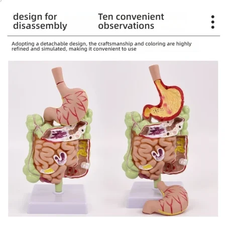 Large Intestine Pathology Model for Human PVC Gastrointestinal Anatomy with Diseased Colon Cecum Rectum Duodenum for Training