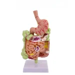 Large Intestine Pathology Model for Human PVC Gastrointestinal Anatomy with Diseased Colon Cecum Rectum Duodenum for Training