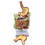 Large Intestine Pathology Model for Human PVC Gastrointestinal Anatomy with Diseased Colon Cecum Rectum Duodenum for Training