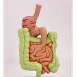 Large Intestine Pathology Model for Human PVC Gastrointestinal Anatomy with Diseased Colon Cecum Rectum Duodenum for Training
