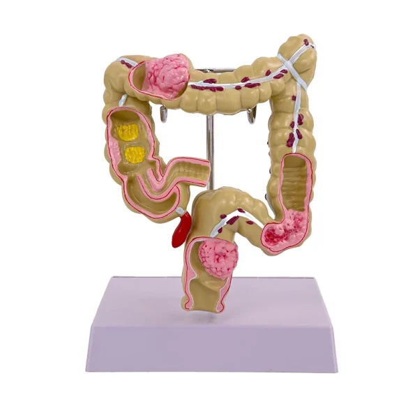Large Intestine Pathology Model Silicone Organ and Head Model for Gastrointestinal and Colon Disease Anatomy Training