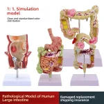 Large Intestine Pathology Model Silicone Organ and Head Model for Gastrointestinal and Colon Disease Anatomy Training
