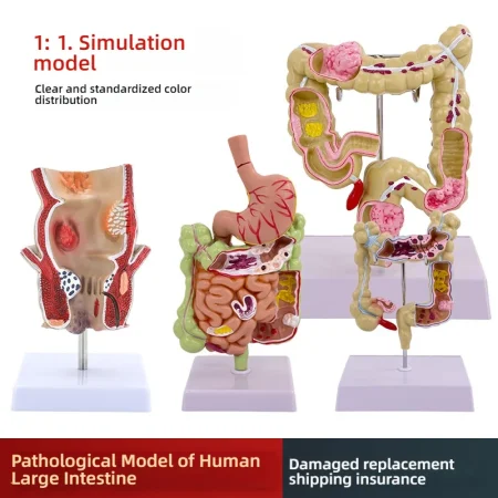 Large Intestine Pathology Model Silicone Organ and Head Model for Gastrointestinal and Colon Disease Anatomy Training